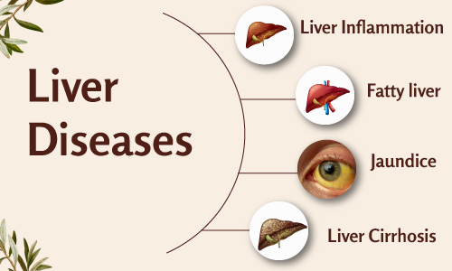What Is Fatty Liver disease